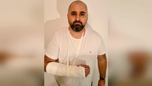 Poslanec zo Sme rodina podal trestné oznámenie na vyšetrovateľa kvôli napadnutiu