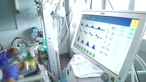 Mnohé deti boli bezpríznakové, teraz majú postcovidový syndróm