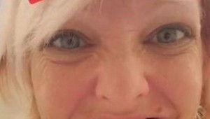 Iné by to skrývali, ona sa nehanbí: Keď uvidíte jej celú tvár, zostanete v šoku