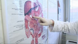 Kŕče v bruchu. Môže to byť aj helikobakter