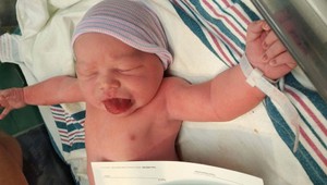 Narodil sa s jazykom štyrikrát väčším ako jeho ústa: Dnes má 3 roky a takto vyzerá