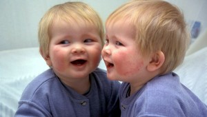 5 mýtov o atopickom ekzéme.  Aj vy sa bojíte, že sa ním nakazíte?