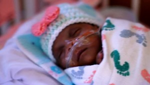 VIDEO: Najmenšie dieťa na svete je už doma. Po narodení vážilo len 245 gramov
