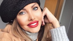 Kollárová misska prvýkrát BEZ MEJKAPU: Očarila by vás aj touto tvárou?