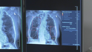 Umelá inteligencia pomáha lekárom: Automaticky zvýrazňuje diagnózy na röntgene