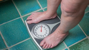 Schudnúť sa dá. Nová kampaň, ktorá rúca mýty o obezite!