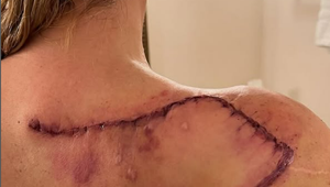 Trpké priznanie krásnej moderátorky! Podstúpila už 16 operácií, teraz jej našli nádory na mozgu!