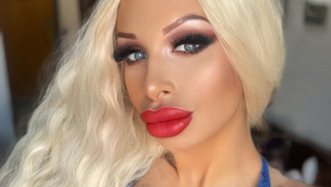 Silikónovej kráske doma explodovalo prso: Jej nechutné VIDEO je len pre silné žalúdky!