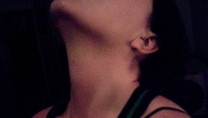 Prečo vás páli záha:  Príčinou môže byť nadváha aj lieky