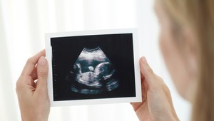 Zvažujú register pre ženy, ktoré stratili panenstvo. Psychológovia hovoria o vlne samovrážd