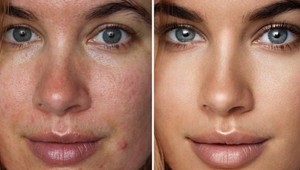 Túto influencerku ženy milujú: Odmieta si upravovať fotky a nebojí sa TO ukázať svetu