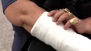 Muž tvrdí, že ho brutálne dobil policajt a vraj zlomil ruku aj jeho manželke. Polícia to odmieta