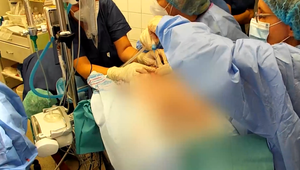 Unikátna operácia pankreasu zachová u pacienta produkciu inzulínu