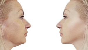 Chcete sa zbaviť dvojitej brady? TU je cvik, ktorý zaberie už za pár dní