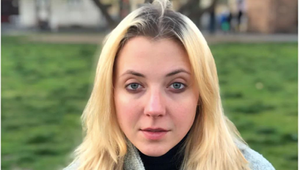 Desivá intímna fotka mladej Slováčkovej (27)! Popáleniny po ožarovaní pri liečbe rakoviny!