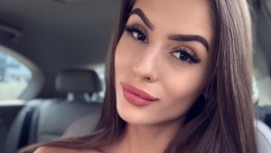 POPÁLENÁ česká youtuberka Týnuš ukázala tvár bez retuše: Jazvy sa jej pomaly hoja