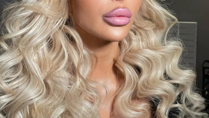 Zbohom kačacie pery: Sexi Slovenka sa zbavila veľkých pier...TOTO jej po nich zostalo!