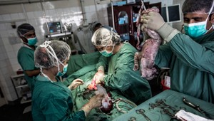 Plánované cisárske rezy môžu zvýšiť riziko niektorých druhov rakoviny u detí, tvrdia vedci