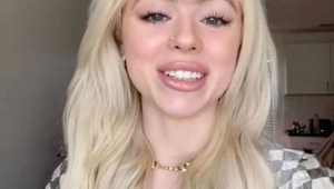 Hejteri ju urážajú, že vyzerá ako opica: Čo poviete, mala by si TO z tváre odstrániť?