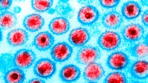 Skvelá správa : Už štvrtý človek sa vyliečil z vírusu HIV!