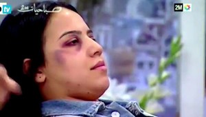 Televízia radila ženám, ako skryť monokle pod mejkap