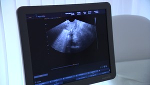 Poslanci napriek ekonomickej kríze riešia interupcie