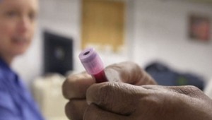 Nová liečba rakoviny bez chemoterapie. Výrazne zníži až vylúči riziko návratu