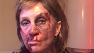 Basiková šokovala fotkami, dobitá na nepoznanie!