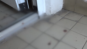 Muž upozornil nočných výtržníkov. Skončil s otrasom mozgu