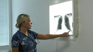 Nedostatok pľúcnych lekárov: Nové ambulancie sa finančne neoplatia, čo bude s pacientmi?