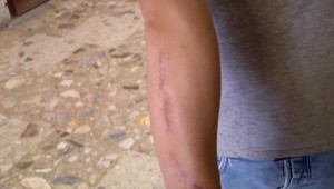 Pokračuje súd s mužom, ktorý takmer dobodal dvoch ľudí