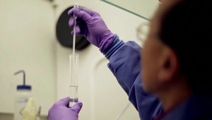 Alzheimerovu chorobu v začiatkoch môže v budúcnosti odhaliť jednoduchý test moču