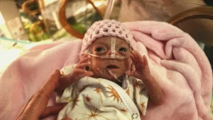 Príbeh Vanesky, ktorá sa po narodení vošla do dlane