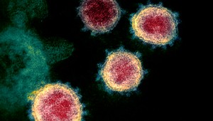 Dva včasné varovné signály, že môžete mať omicron