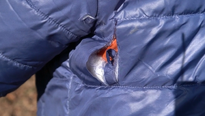 Dôchodcu napadol rozzúrený pes. Jeho majiteľ bez slova odišiel