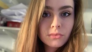 Nikola sa vyhladovala na 38 kilogramov: Jej šokujúce FOTKY majú pomôcť mladým dievčatám