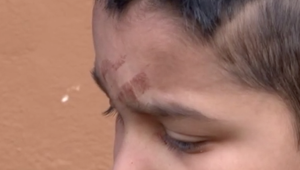 Malého Lukáša (7) zrazili dvaja cyklisti a z miesta ušli. Začína mať psychické problémy, vraví mama