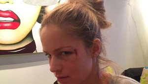 Surovcovú trafil na zápase do tváre puk. Čo na to Gáborík?