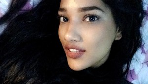 Mohla byť úspešnou modelkou, keby... Pozrite sa na jej telo a pochopíte