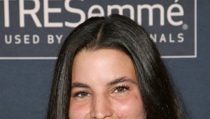 Modelku pohrýzol pes rovno do tváre: Pozrite sa, ako vyzerá po unikátnej operácii