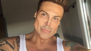 Ďalšie plastikové monštrum. Po extrémnych operáciách sa rozpadá