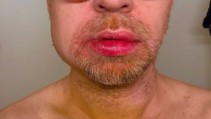 Kolaps zmenil fešného speváka na nepoznanie! Tvrdé pády mu radikálne zmenili tvár!