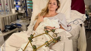 Lindsey VONN má za sebou štvrtú operáciu, čaká ju transport domov