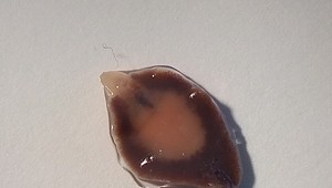 Motolica v pečeni? Ľudia si ju vozia z exotiky, tvrdí parazitológ