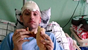 Róbert z Novej Dubnice utrpel ťažký úraz. Žije bez časti mozgu