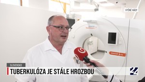 Rozhovor o tom, že tuberkulóza je stále hrozbou