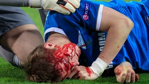 VIDEO. Van Persie s hetrikom, Hubočan s krvavou hlavou