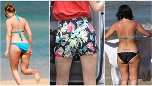 Celulitída poľuje aj na celebrity: Spravodlivosť existuje!