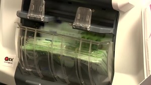 Skríning na ochorenie SMA bude môcť zachrániť život