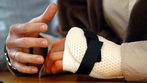 Kuzminovej úsmev po operácii veští, že sa čoskoro vráti v plnej sile